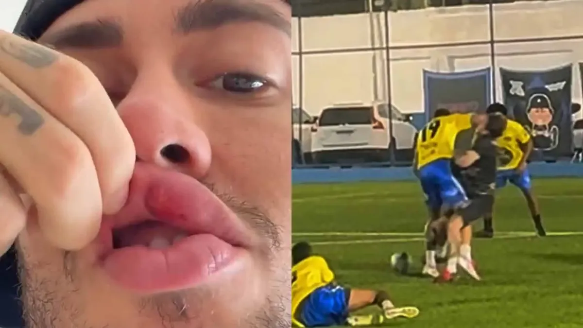 MC Daniel sofreu uma cotovelada de Fernandão, ex-Bahia, em um jogo beneficente