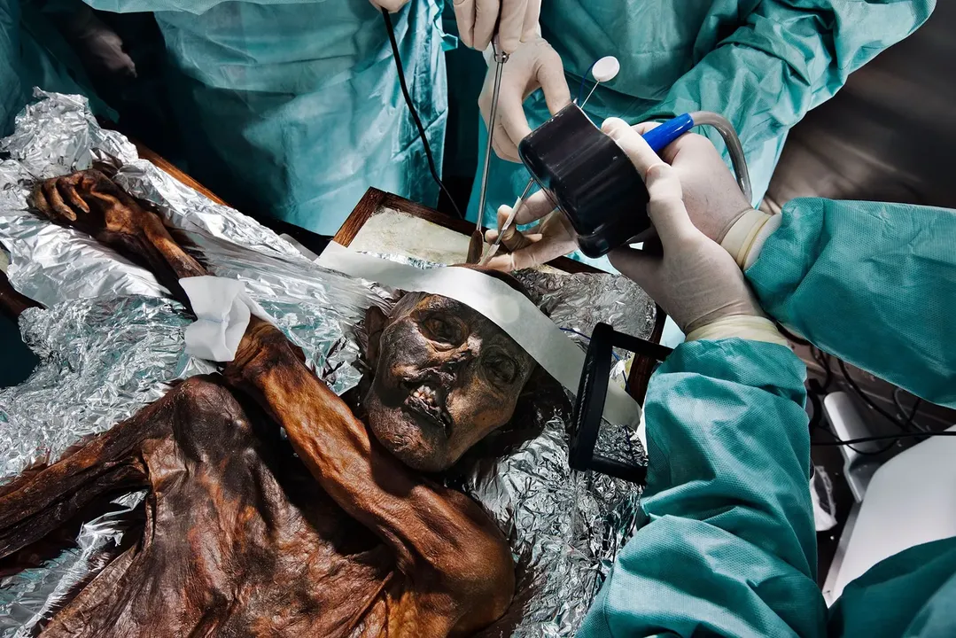 Restos mortais de Ötzi, o Homem do Gelo, de 5,3 mil anos