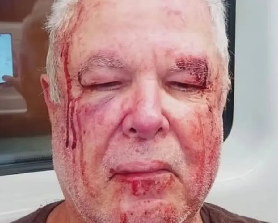Imagem ilustrativa da imagem Idoso militante do PT é agredido e motivação política é investigada