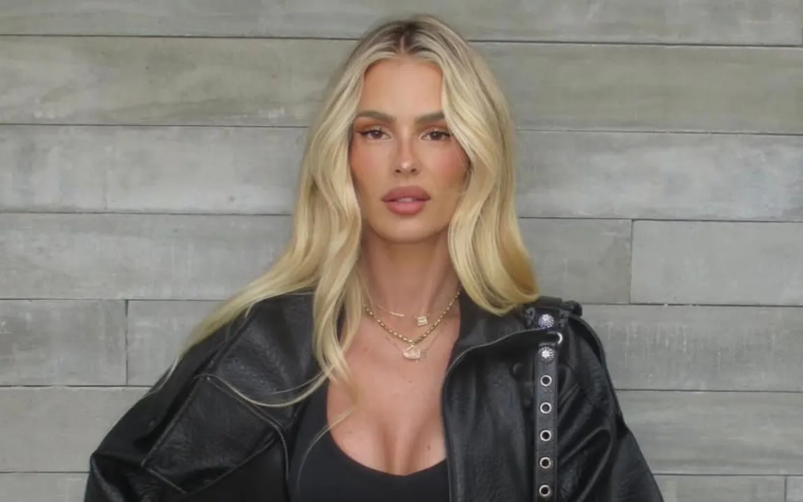 A modelo foi diagnosticada com lipedema
