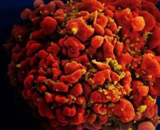 Terceiro paciente com HIV é curado após transplante de células-tronco