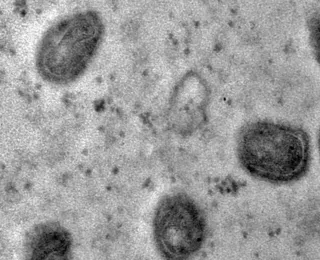 OMS declara fim da emergência em saúde por mpox