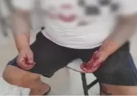 Aluno com espectro autista é agredido por professor em escola do MT