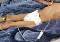 Avó de menina de 3 anos encontrada desnutrida ganha guarda provisória