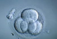 Cientistas criam 1º embrião humano sintético em laboratório do mundo