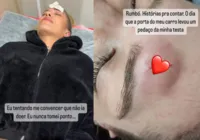 Lore Improta leva pontos na testa após acidente com porta do carro