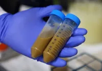 Mulher revela que curou distúrbio intestinal com transplante de fezes