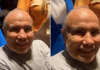 Stênio Garcia mostra rosto desinchado após harmonização: "gatão"