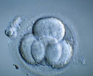 Cientistas criam 1º embrião humano sintético em laboratório do mundo