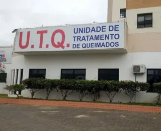 SAJ: hospital registra aumento no número de atendimentos a queimados