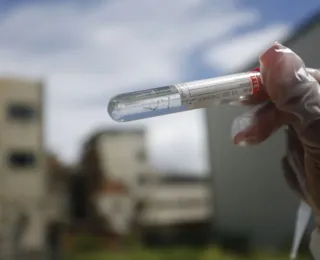 Testes para chikungunya e tuberculose estão escassos no Brasil