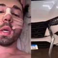 Rico Melquiades sofre acidente de carro e pede Pix aos seguidores imagem