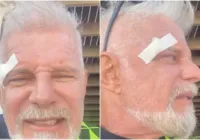 Ator Raul Gazolla sofre acidente em praia no CE: "abri a testa"