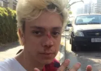 Ator Victor Meyniel é vítima de homofobia em prédio no Rio de Janeiro