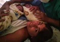 Bruna Surfistinha revela que coluna travou após anestesia do parto imagem