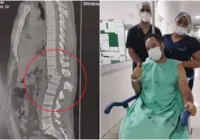 Homem volta a sentir as pernas após acidente em academia