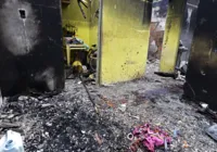 Morre criança que teve mais de 50% do corpo queimado em chacina