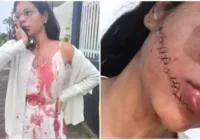 Suspeita de cortar rosto de jovem em ônibus na Bahia é presa em SP