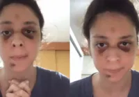 Victor Meyniel diz que porteiro o arrastou por "atrapalhar a passagem"