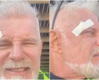 Ator Raul Gazolla sofre acidente em praia no CE: "abri a testa"