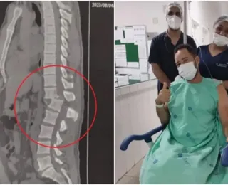 Homem volta a sentir as pernas após acidente em academia