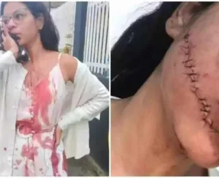Suspeita de cortar rosto de jovem em ônibus na Bahia é presa em SP