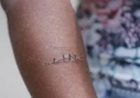 Adolescente relata ferimento em parque dias antes de grave acidente