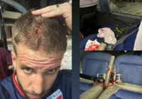 Jogadores do Fortaleza se pronunciam após atentado: "São bandidos"