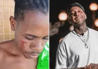 Vídeo: Kannário dá soco e sangra homem em Lauro; cantor se defende