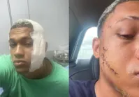 Vídeo: câmera flagra momento em que jovem recebe garrafada no rosto