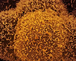 Nova subvariante da covid-19 é identificada em Mato Grosso