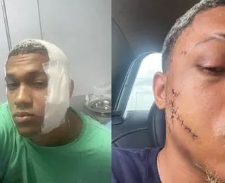 Vídeo: câmera flagra momento em que jovem recebe garrafada no rosto