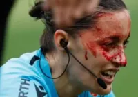 Auxiliar volta ao futebol após grave choque com câmera; veja