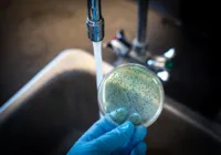 Brasil confirma caso autóctone de cólera em Salvador