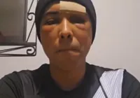 Brasileiro é agredido na Irlanda e relata xenofobia: "Pesadelo"; vídeo