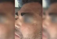 Guardas municipais são suspeitos de agredir homem com madeira