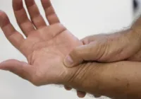 Mais comum até os 40, doença autoimune pode ser incapacitante