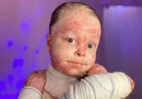 Morre Dai Cruz, influenciadora baiana que tinha doença rara