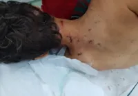 Motorista esfaqueada 20x tem alta: "Medo dele terminar o que começou"