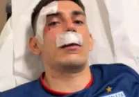 PM de Pernambuco sabia de explosivos antes do jogo Sport e Fortaleza