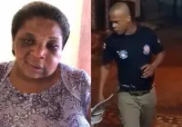 Vídeo: Mulher agredida por PM em Camamu aparece com rosto deformado