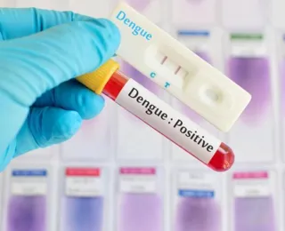 Anvisa adia decisão sobre comercialização de autotestes da dengue