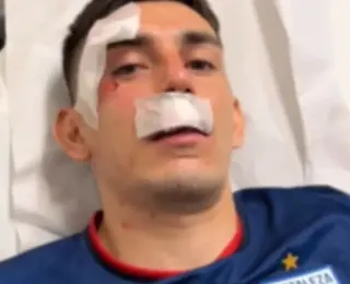 PM de Pernambuco sabia de explosivos antes do jogo Sport e Fortaleza