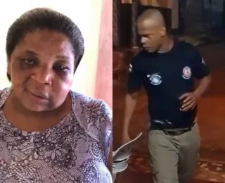 Vídeo: Mulher agredida por PM em Camamu aparece com rosto deformado