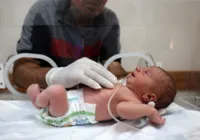 Bebê é resgatado na barriga de mulher morta no bombardeio em Gaza