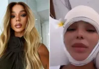 Esposa de Ludmilla reduz testa em cirurgia; saiba detalhes