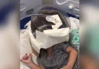 Hospital do RN usa embalagem de bolo como máscara de oxigênio em bebê
