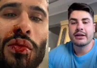 Laéllyo Mesquita surge ensanguentado e acusa Lucas Souza: "Aguardem"