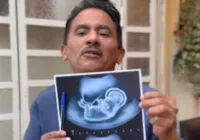 Manoel Gomes, da "Caneta Azul", será pai pela primeira vez