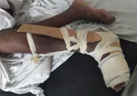 Mata de São João paga altos cachês, mas não tem gesso no hospital